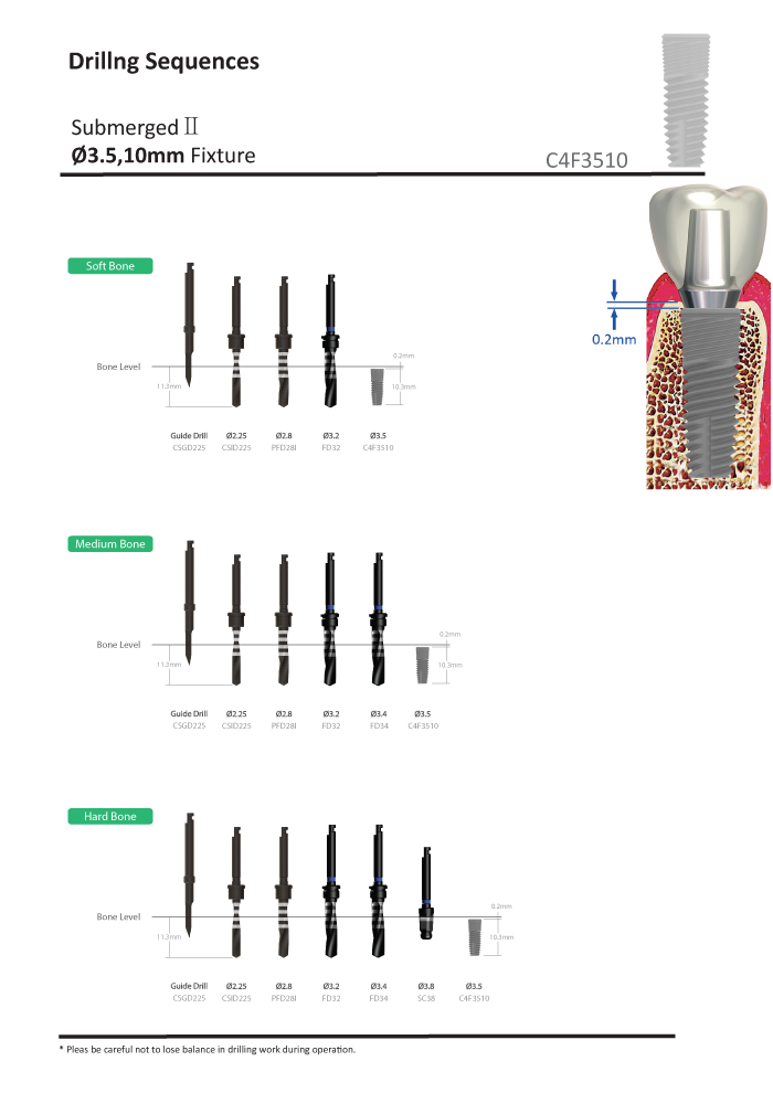 internal implant operation procedure